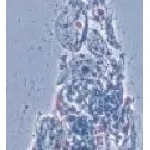Phase Contrast Microscopy